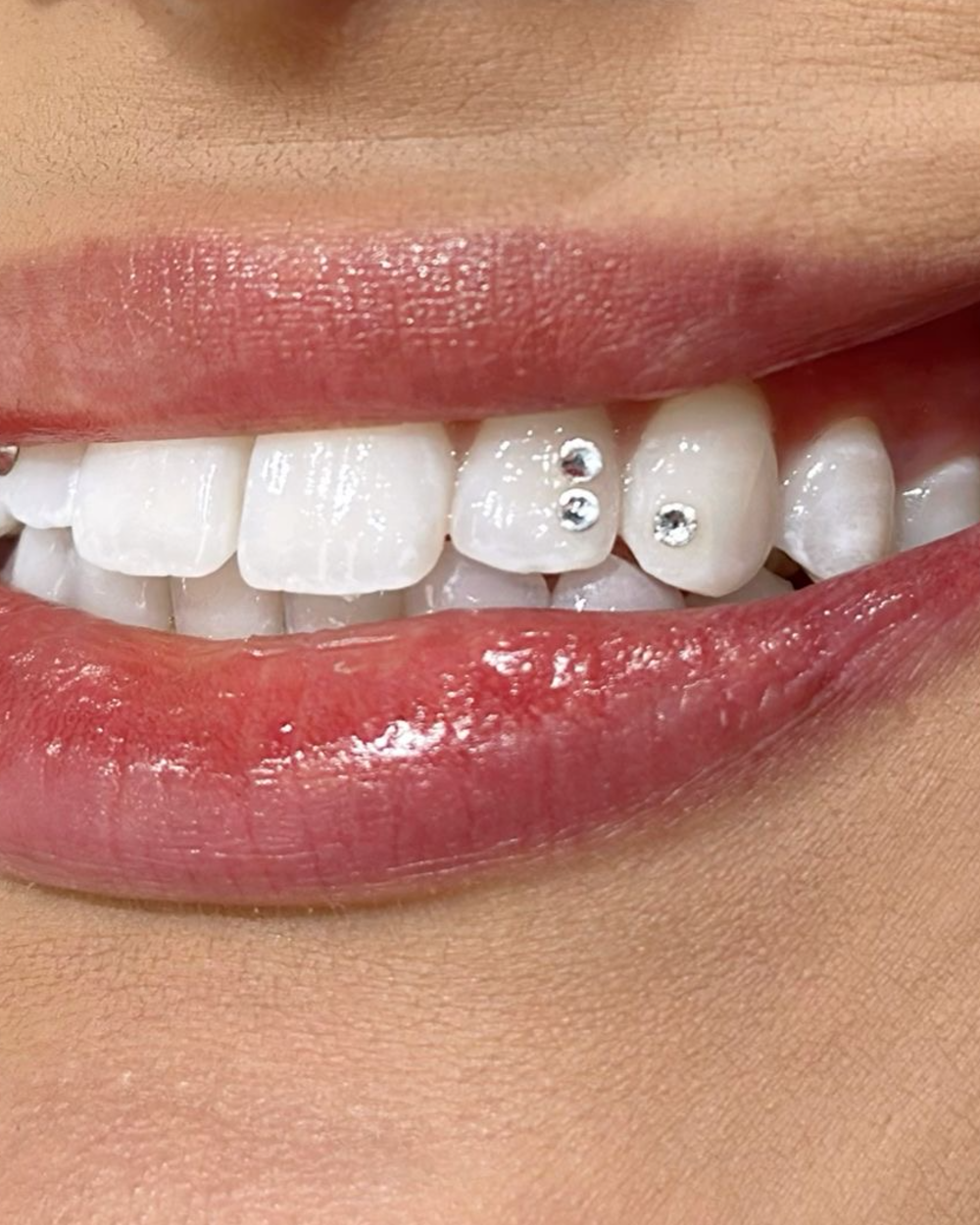 tooth gems
